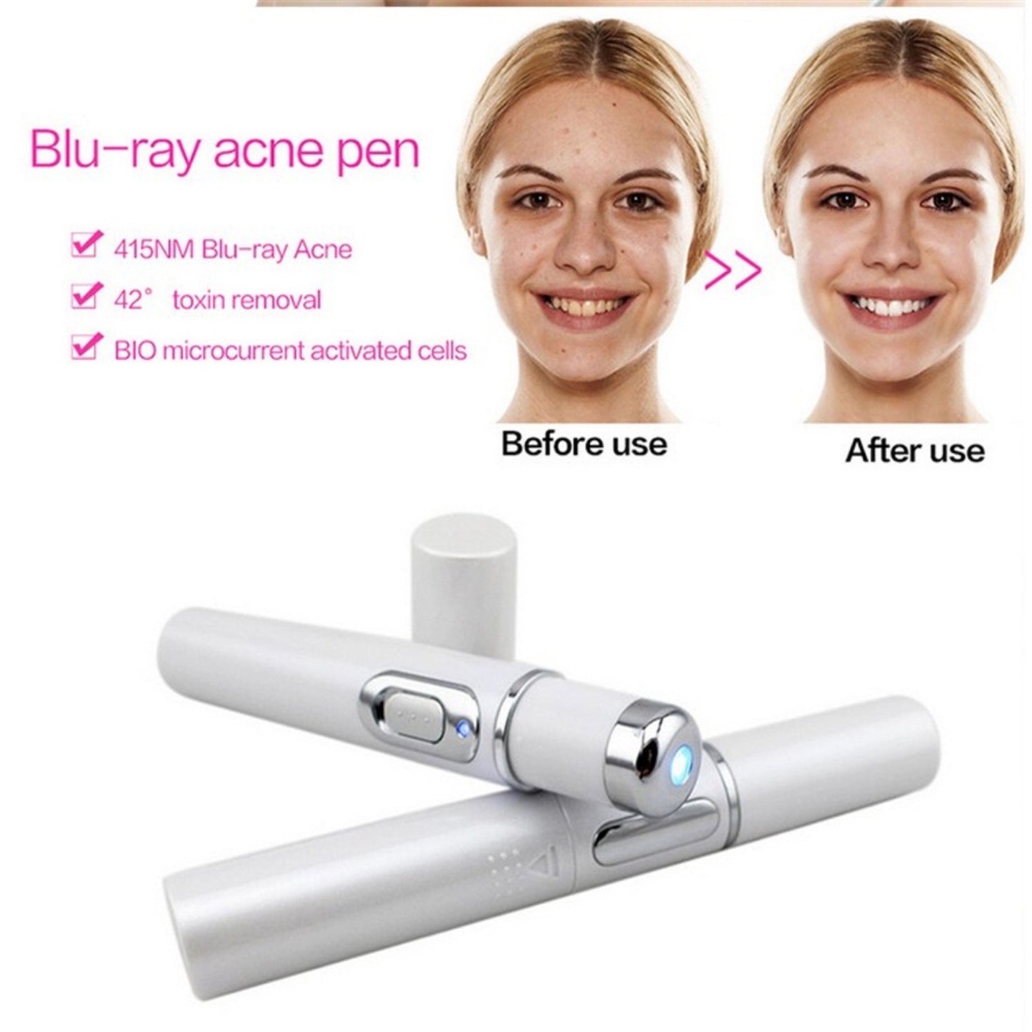 Blue Light Therapy Acne Laser Pen - Soft Scar & Wrinkle Removal Treatment Device for Skin Care