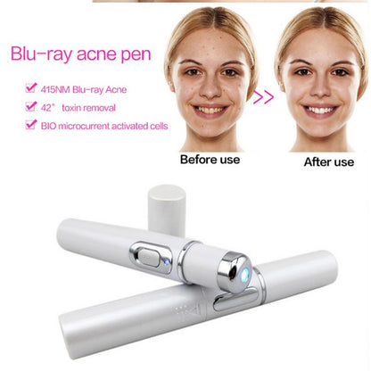 Blue Light Therapy Acne Laser Pen - Soft Scar & Wrinkle Removal Treatment Device for Skin Care