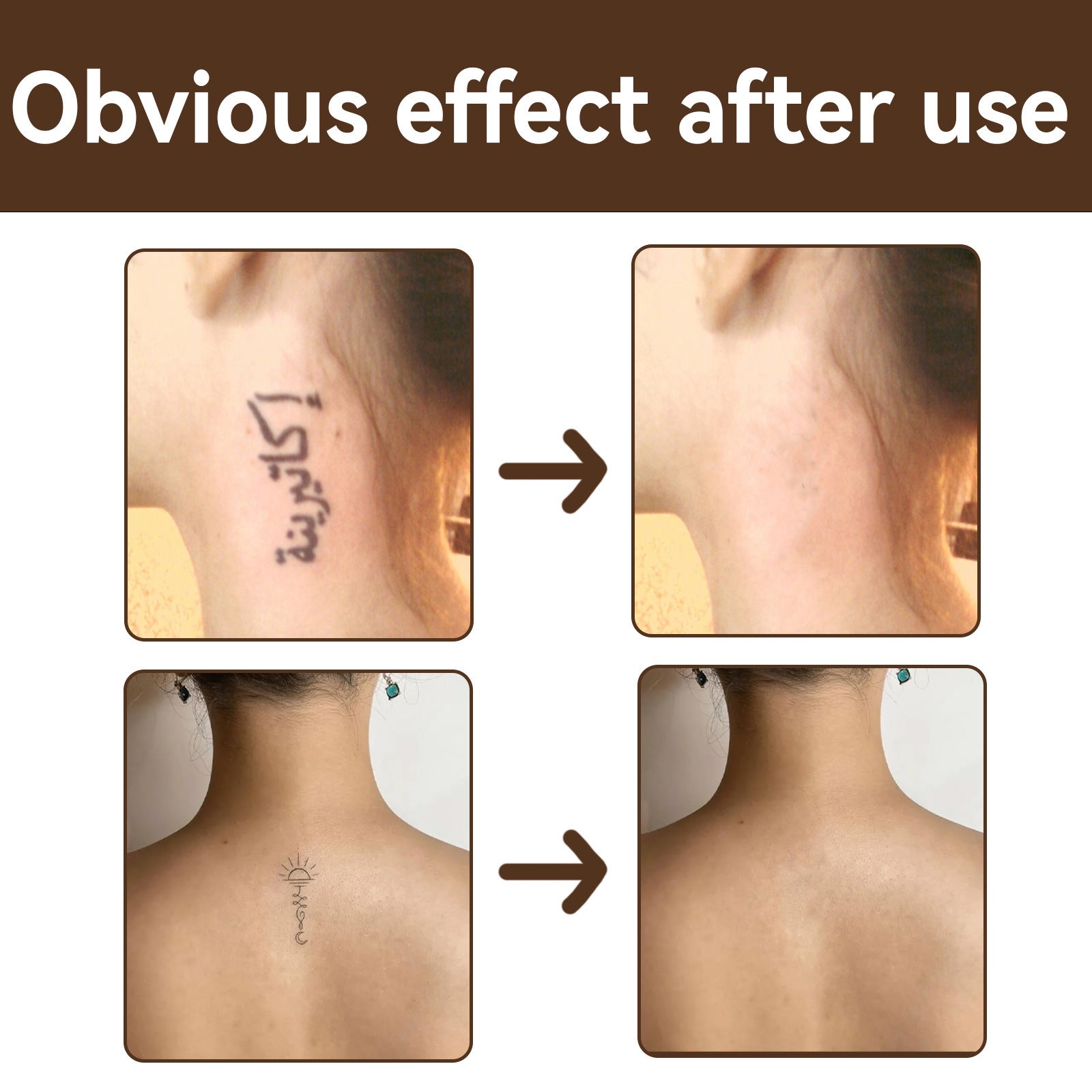 Tattoo-Abdeckkappe, Narben- und Muttermalabdeckung, wasserfest