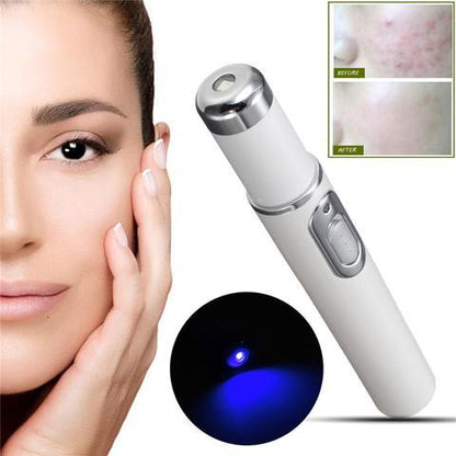 Blue Light Therapy Acne Laser Pen - Soft Scar & Wrinkle Removal Treatment Device for Skin Care